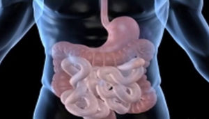 PROFILAKTYKA SCHORZEŃ JELITA GRUBEGO I PROSTATY